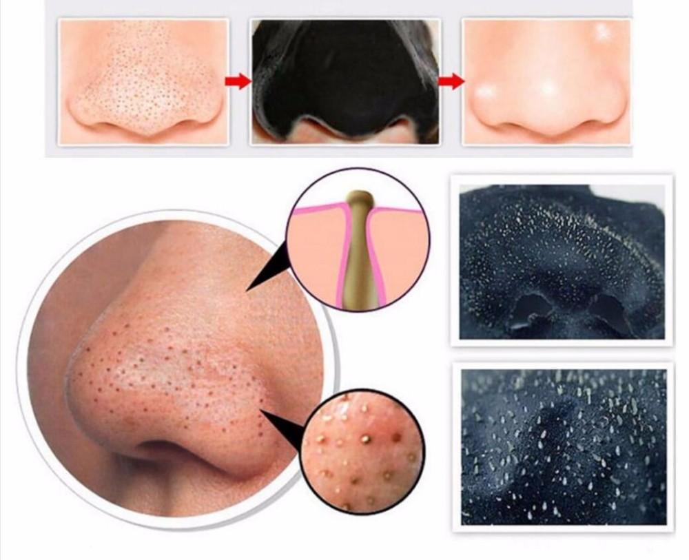 Activated Charcoal Blackhead Removal Mask and Strips