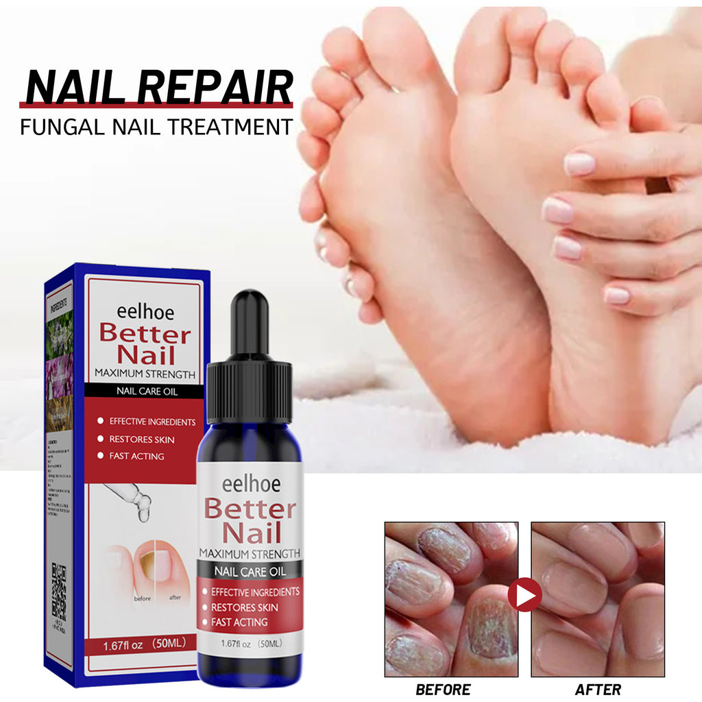 Eelhoe Nail Revitalizer