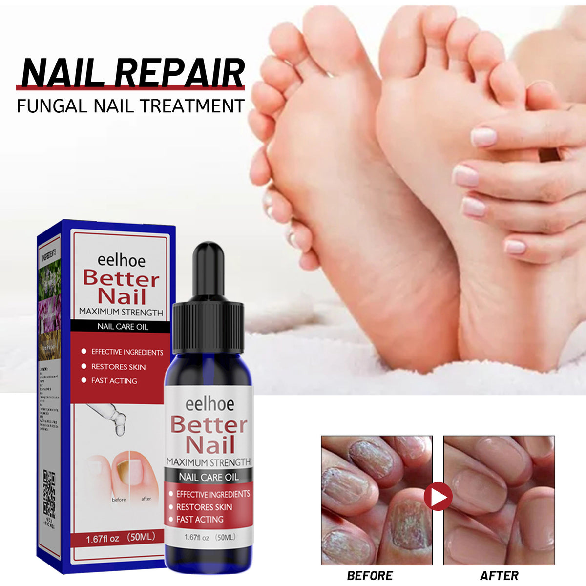Eelhoe Nail Revitalizer