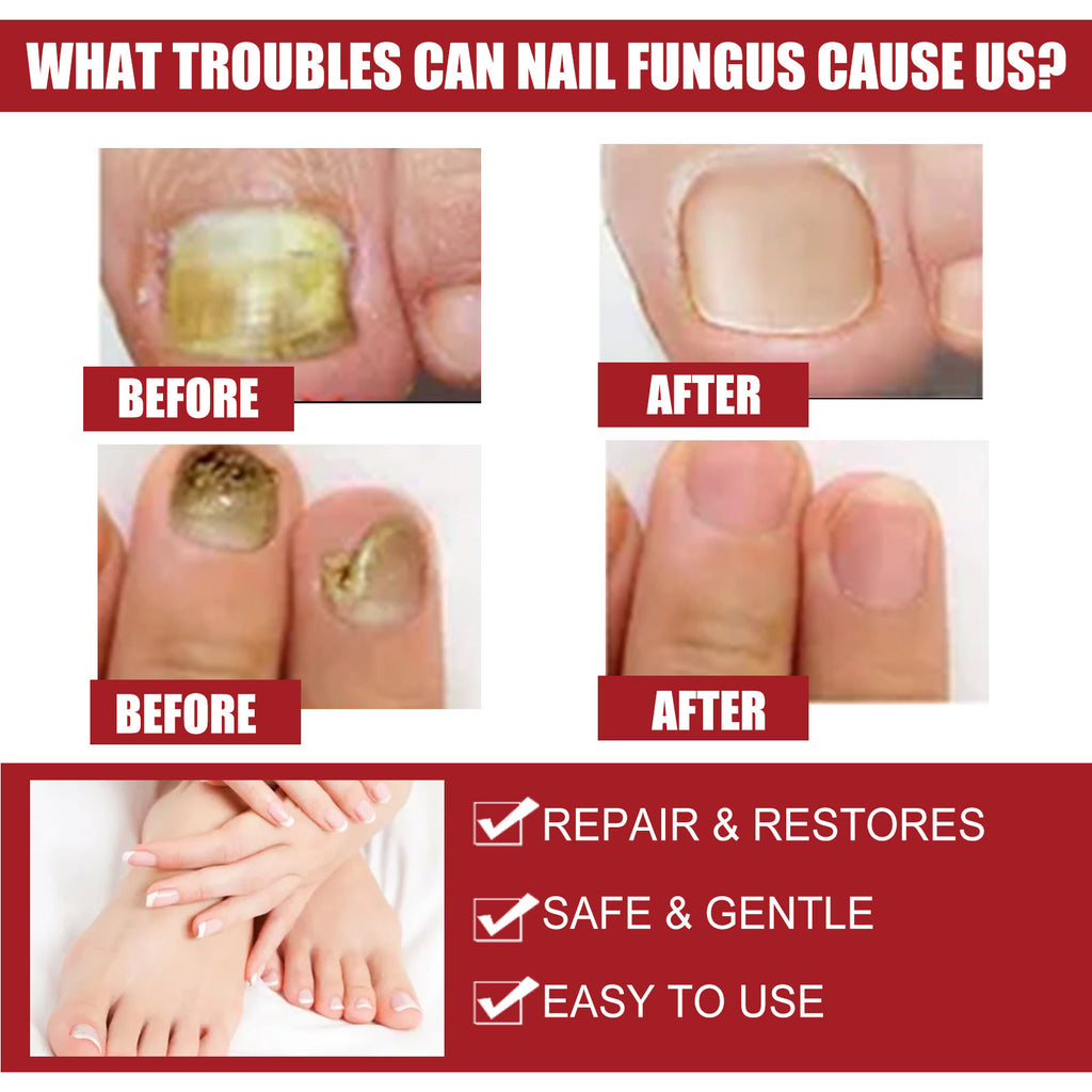 Eelhoe Nail Revitalizer