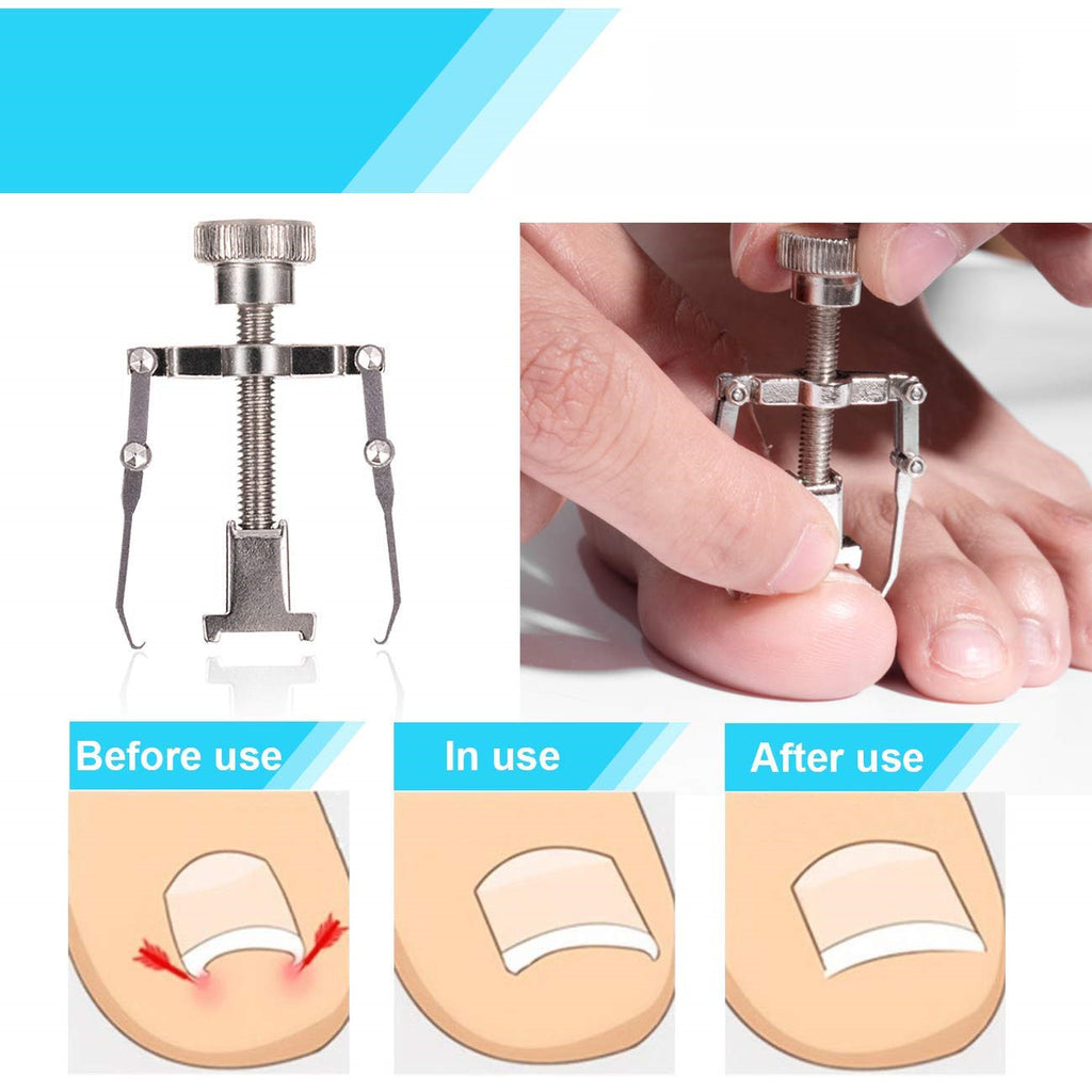 Elite 12-Piece Nail Care Set