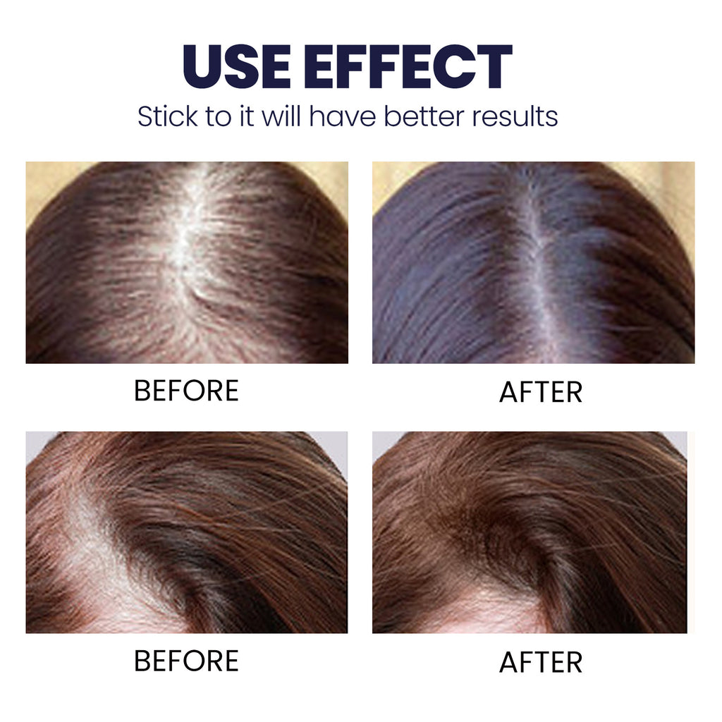 OUHOE Revitalizing Hair Fortifier