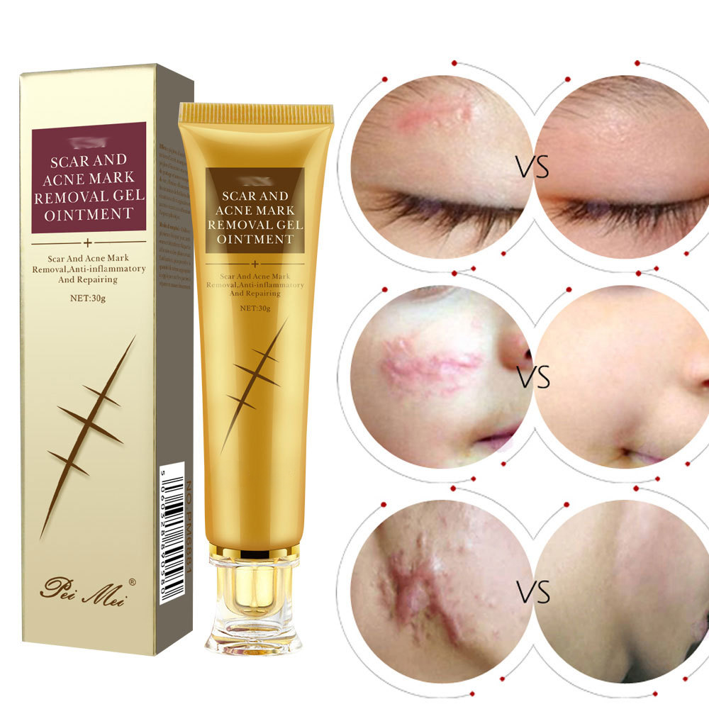 Regenerative Scar Therapy Cream
