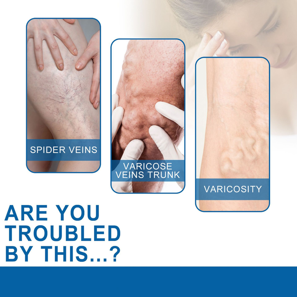 VeinEase Leg Serum