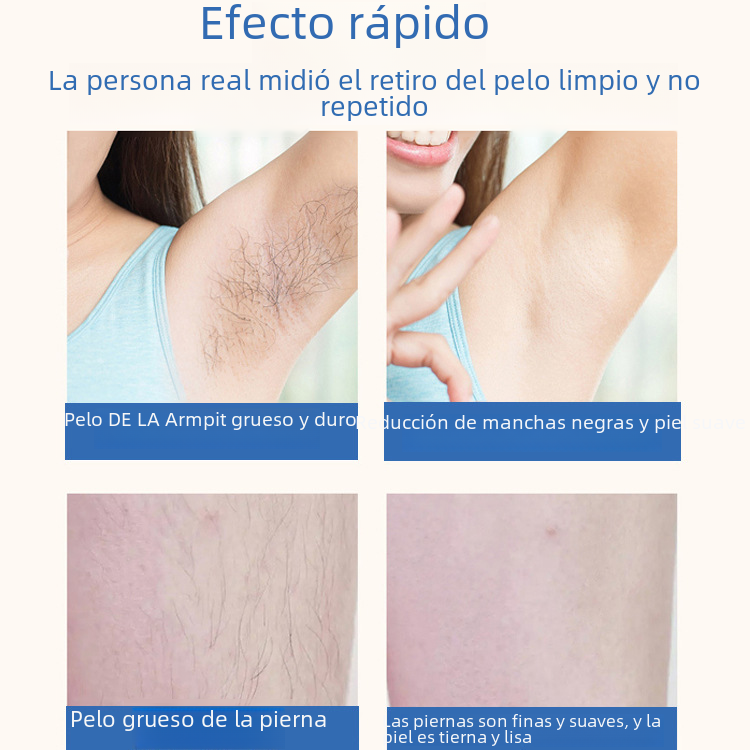 Precision Laser Hair Reducer