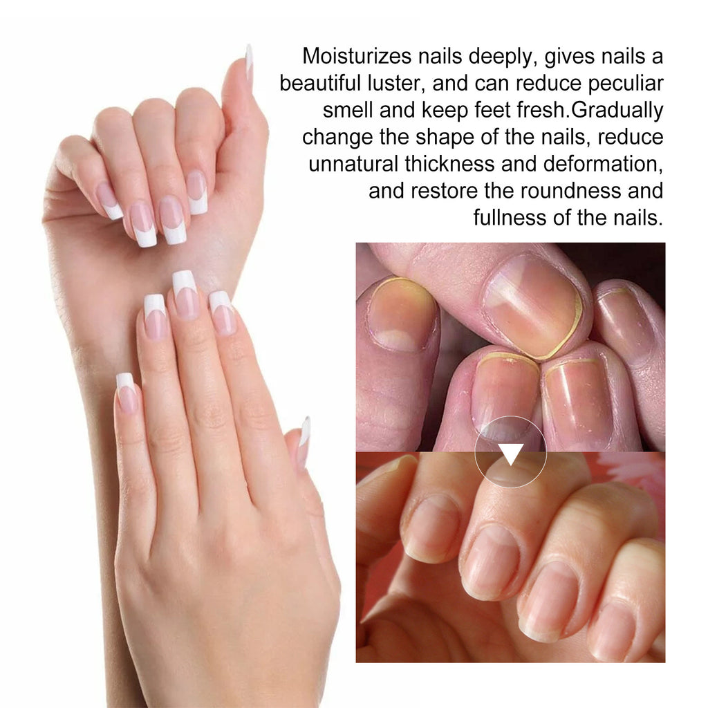 Ximonth Nail Repair Essence for Thickening and Care