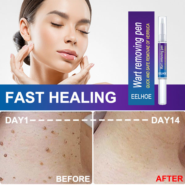EELHOE Skin Tag and Wart Removal Liquid Pen
