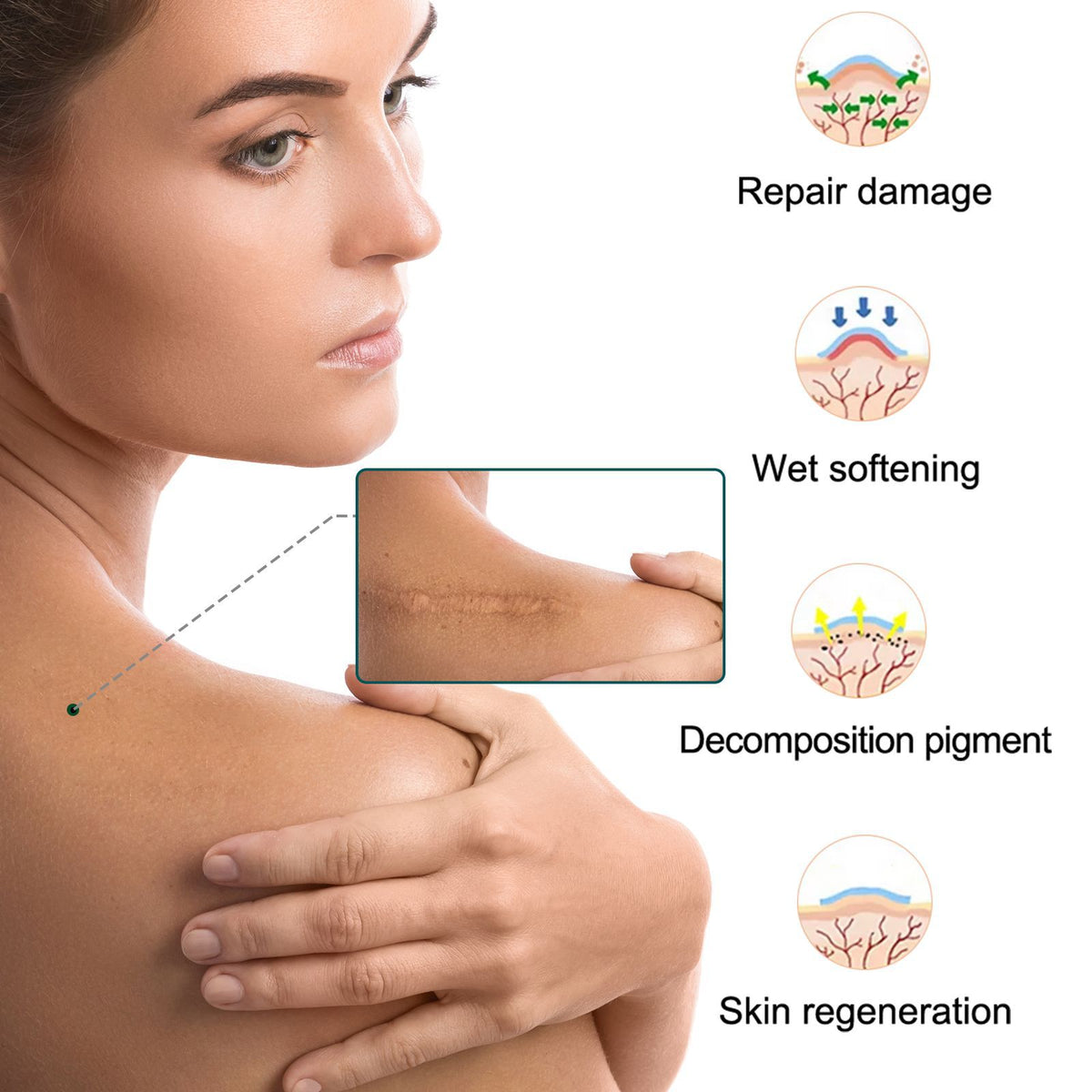 ELAIMEI Surgical Scar Healing Gel