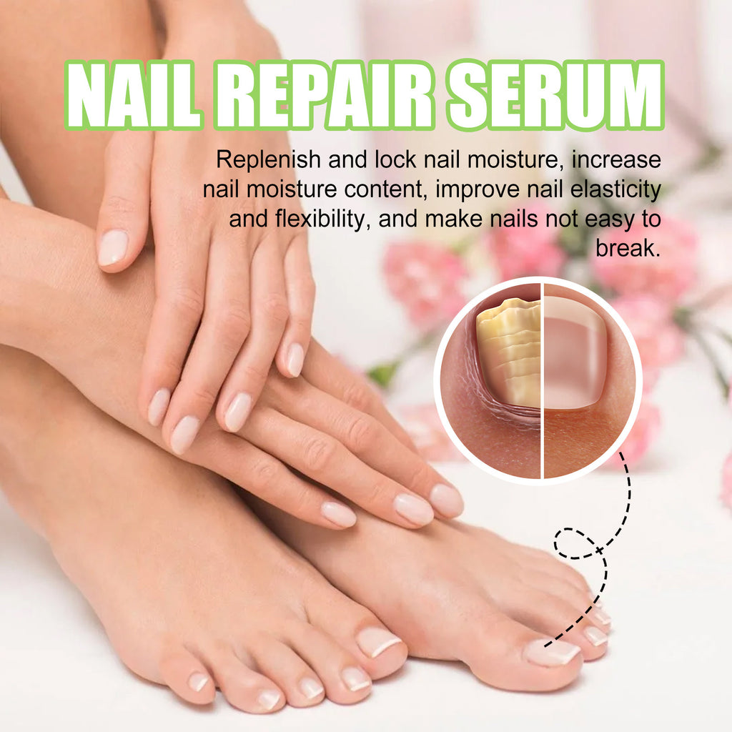 Ximonth Nail Repair Essence for Thickening and Care