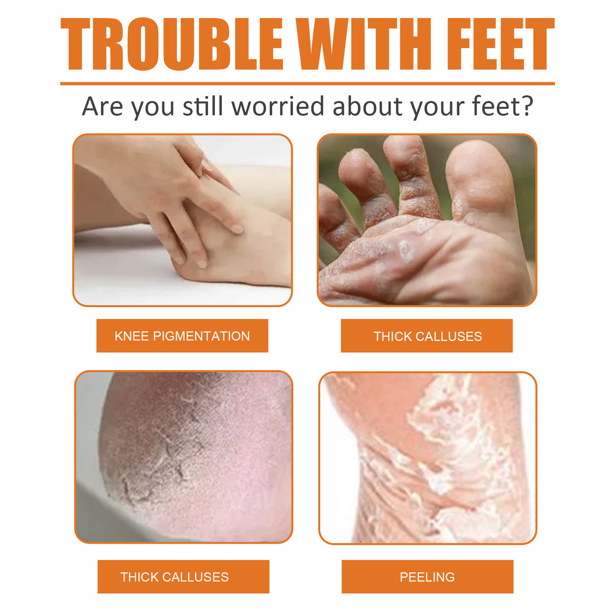South Moon Exfoliating Foot Spray for Dry Cracked Skin
