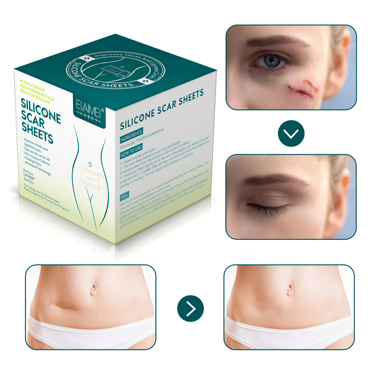 ELAIMEI Surgical Scar Healing Gel