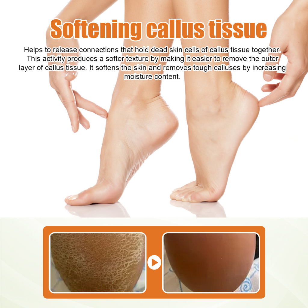 South Moon Exfoliating Foot Spray for Dry Cracked Skin
