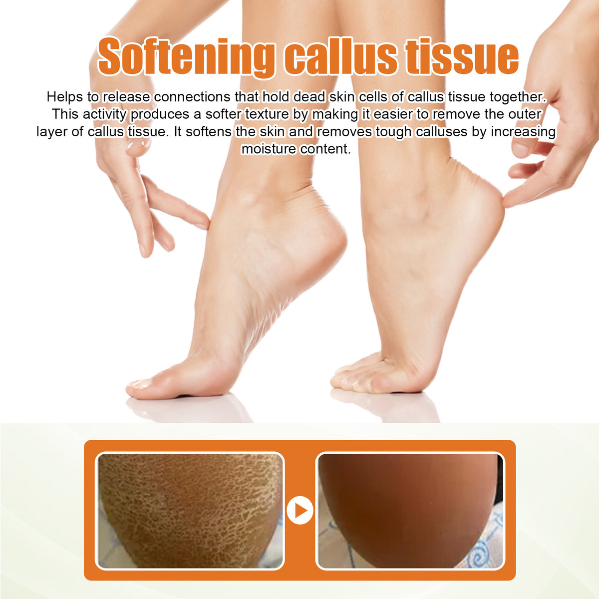 South Moon Exfoliating Foot Spray for Dry Cracked Skin
