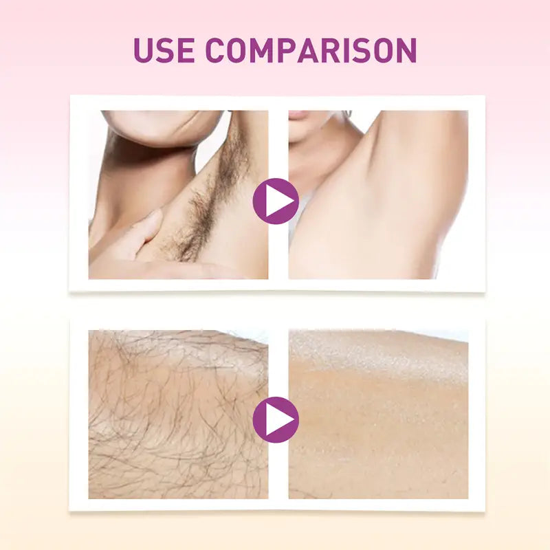 Serene Body Hair Removal Solution