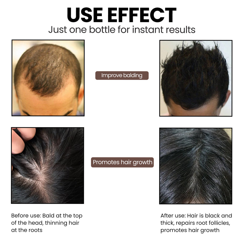 EELHOE Root Nourishing Hair Essence