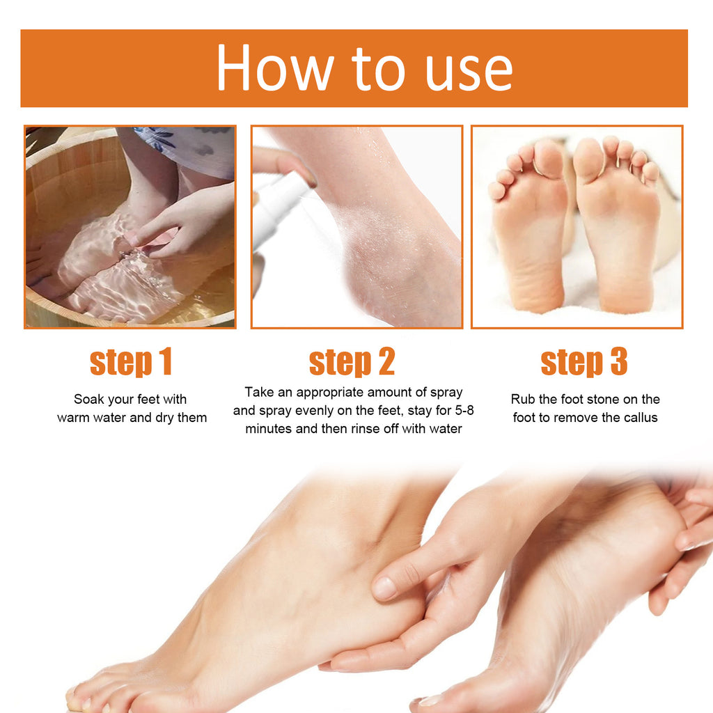 South Moon Exfoliating Foot Spray for Dry Cracked Skin