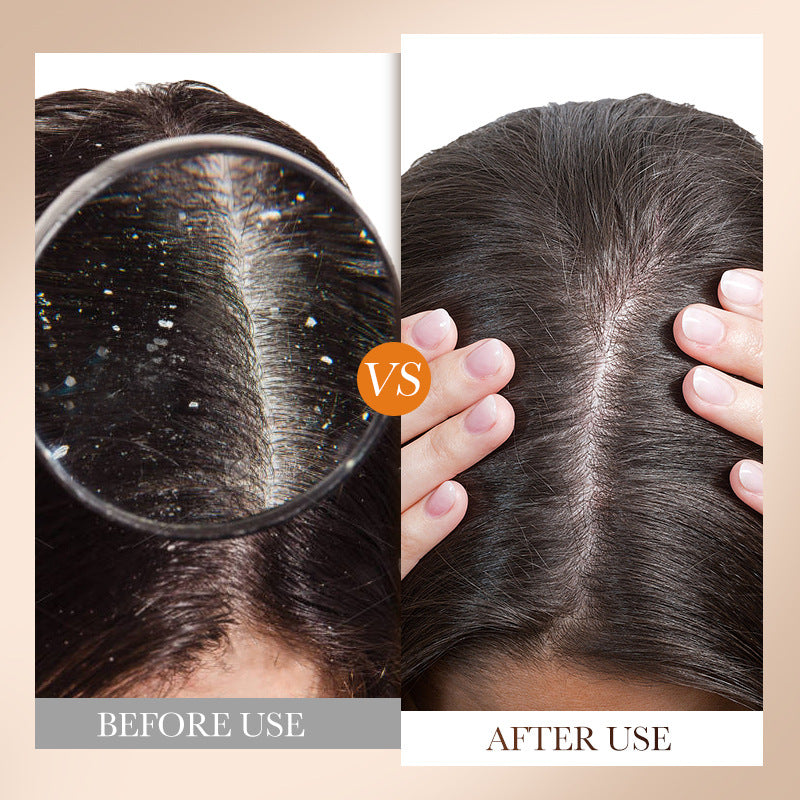 SADOER 500ml English Shampoo & Anti-Dandruff Conditioner