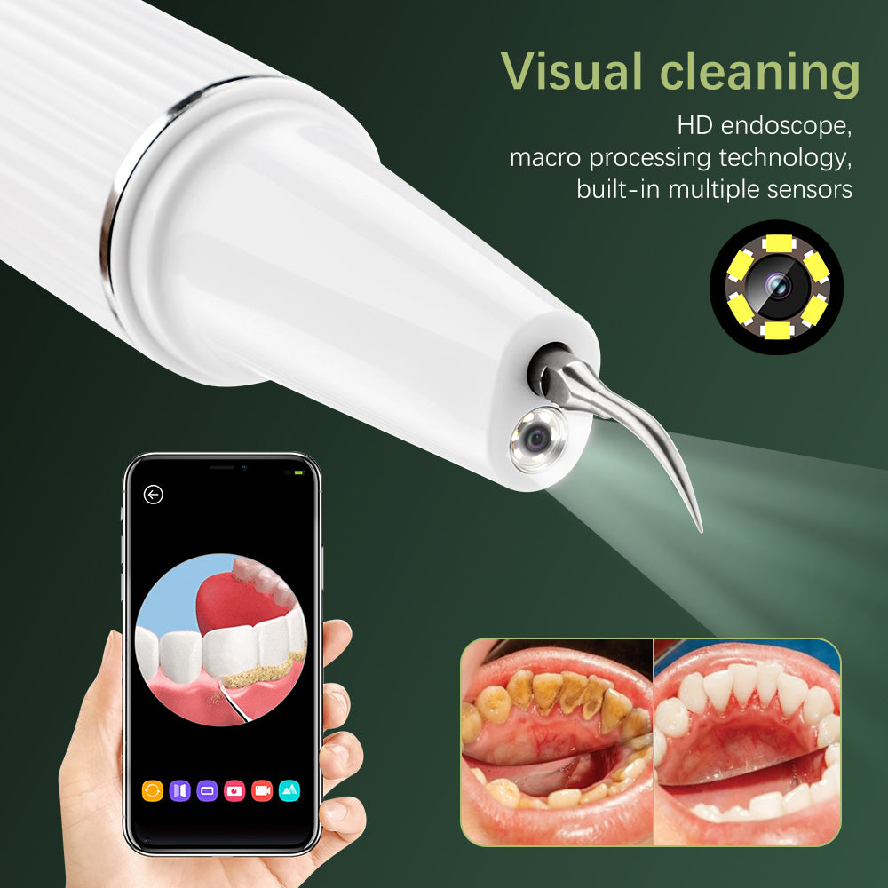 Ultrasonic Precision Dental Cleaner