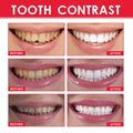 Luminous Teeth Whitening Serum