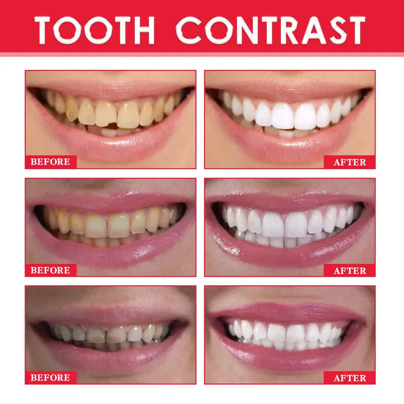Luminous Teeth Whitening Serum